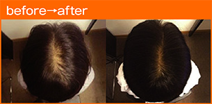 before→after