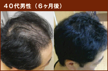 40代男性(6ヶ月後)