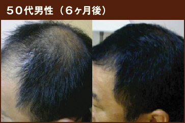 50代男性(6ヶ月後)