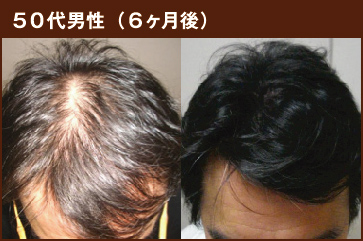 50代男性(6ヶ月後)