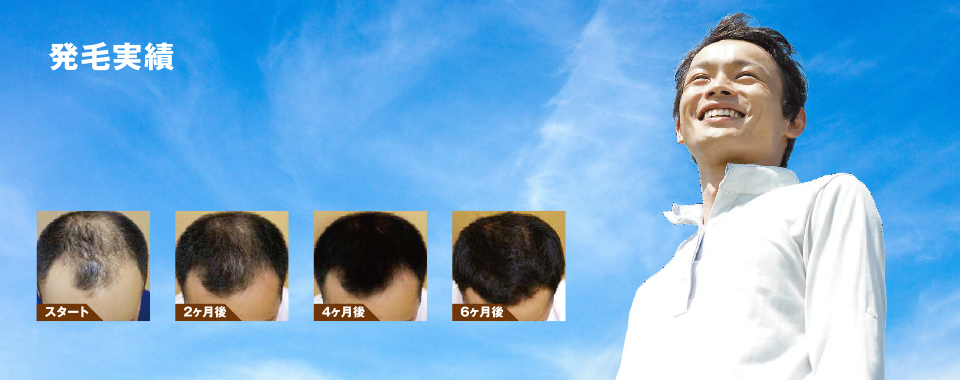 発毛実績